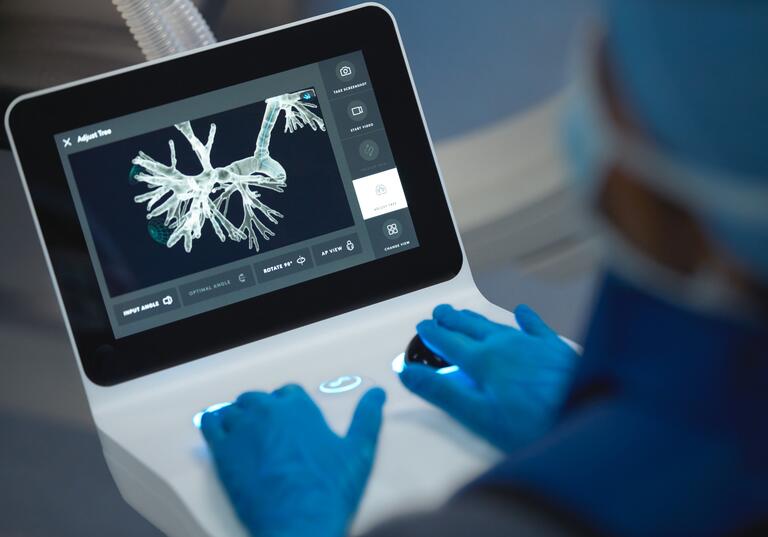 Northwest Hospital Now Using Robotic Technology for Earlier Lung